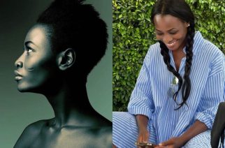 My Own GH People Didn’t Like My Facial Mark But I’m Making Big Money From It In USA – Model