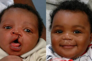 Superstition And Stigma: How Mother Of Seven Nearly Sacrificed Cleft Child