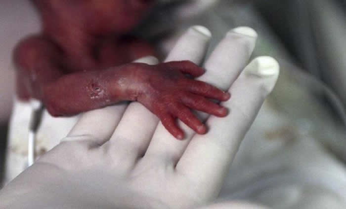 Beheaded At Birth: Young South African Mother Calls For Justice