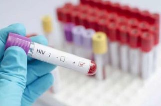 Bono Region Records 844 New HIV Infections