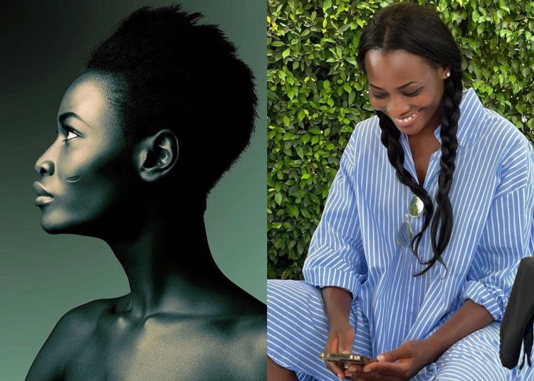 My Own GH People Didn’t Like My Facial Mark But I’m Making Big Money From It In USA – Model